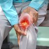 Types of Arthritis: Symptoms, Causes, and Treatments