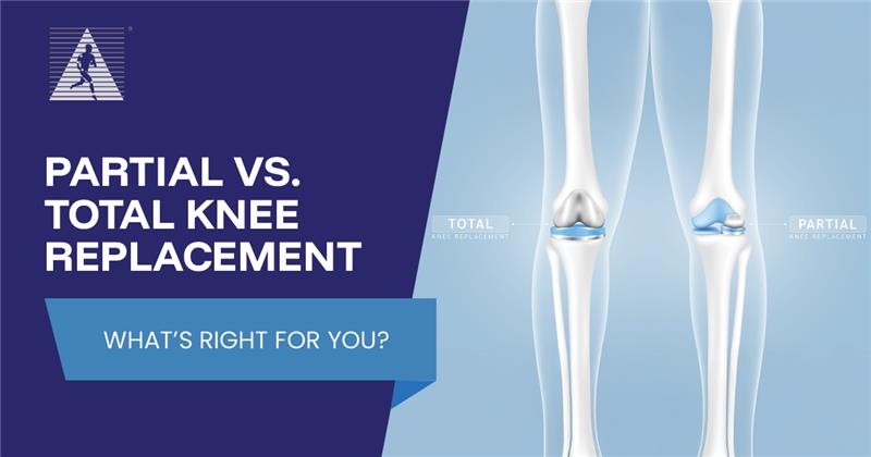 Partial vs. Total Knee Replacement – What’s Right for You?
