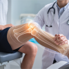 Non-Surgical Solutions That Help Avoid Knee Surgery
