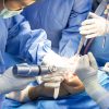 Why Revision Surgeries Are Increasing as Younger Patients Choose Joint Replacement