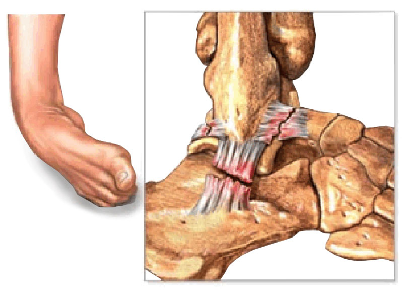 Best Foot and Ankle Specialists in Chandanagar /Hyderabad